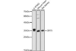 Western blot analysis of extracts of various cell lines, using SIRT5 antibody (ABIN6129331, ABIN6147798, ABIN6147799 and ABIN6221468) at 1:1000 dilution. (SIRT5 Antikörper  (AA 1-310))