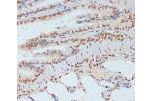 Immunohistochemistry of paraffin-embedded Rat lung using Phospho-p53(S33) Polyclonal Antibody at dilution of 1:100 (40x lens). (p53 Antikörper  (pSer33))