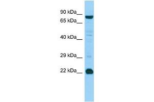 WB Suggested Anti-MED22 Antibody Titration: 1. (MED22 Antikörper  (Middle Region))