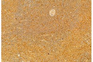 ABIN6264594 and ABIN6279749 at 1/100 staining Rat spleen tissue by IHC-P.