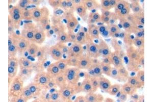 Detection of TAN1 in Mouse Liver Tissue using Polyclonal Antibody to Translocation Associated Notch Homolog 1 (TAN1) (Notch1 Antikörper  (AA 1919-2079))