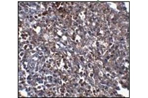 Immunohistochemistry (IHC) image for anti-ORAI Calcium Release-Activated Calcium Modulator 1 (ORAI1) (C-Term) antibody (ABIN492546)
