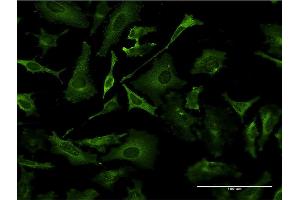 Immunofluorescence of monoclonal antibody to TAP1 on HeLa cell. (TAP1 Antikörper  (AA 241-350))