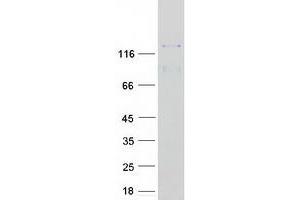 Western Blotting (WB) image for Protein Kinase N2 (PKN2) protein (Myc-DYKDDDDK Tag) (ABIN2729067)