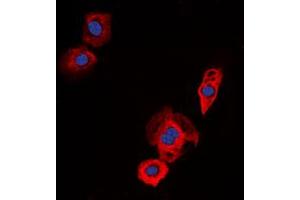 Immunofluorescent analysis of EGFR staining in Jurkat cells. (EGFR Antikörper  (C-Term))