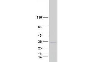Western Blotting (WB) image for F-Box Protein 44 (FBXO44) (Transcript Variant 3) protein (Myc-DYKDDDDK Tag) (ABIN2720966)