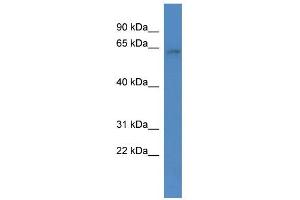 WB Suggested Anti-ARID3B Antibody Titration:  0. (ARID3B Antikörper  (C-Term))