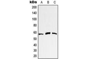 Western blot analysis of c-Myc expression in A431 (A), Jurkat (B), HeLa (C) whole cell lysates. (c-MYC Antikörper  (N-Term))