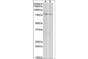 <strong>Western blot analysis:</strong> DAG1 antibody staining of Mouse and Rat Skeletal Muscle lysate at 0. (Dystroglycan Antikörper  (Internal Region))