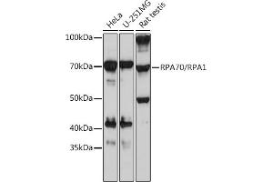 Western blot analysis of extracts of various cell lines, using RP/RP Rabbit mAb (ABIN7269915) at 1:1000 dilution. (RPA1 Antikörper)