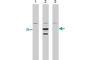 Western blot analysis using RIT1 monoclonal antibody, clone 14G7  on control 293 cells (lane 1), 293 cells expressing HA-tagged RIT1 protein (lane 2) and 293 cells expressing HA-tagged RIT2 protein (3). (RIT1 Antikörper)