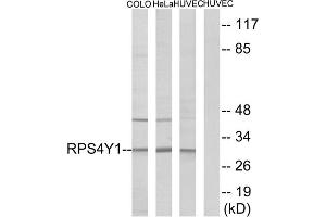 Western blot analysis of extracts from COLO cells, HeLa cells and HUVEC cells, using RPS4Y1 antibody. (RPS4Y1 Antikörper  (C-Term))