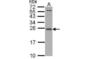 Western Blotting (WB) image for anti-Interleukin 1 Receptor Antagonist (IL1RN) antibody (ABIN2856394)