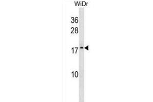 ATP5L2 Antibody (N-term) (ABIN1538885 and ABIN2850205) western blot analysis in WiDr cell line lysates (35 μg/lane). (ATP5L2 Antikörper  (N-Term))