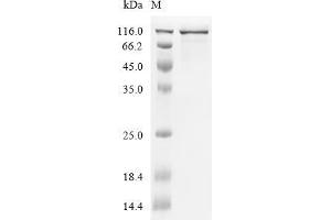 Glypican 3 (GPC3) (AA 25-358) protein (His-HSA tag)