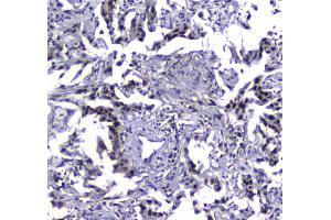 Immunohistochemistry (IHC) image for anti-Mdc1 (MDC1) (AA 534-626) antibody (ABIN5693232)