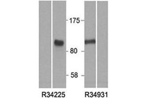 Western blot of HEK293 lysate overexpressing human HIC1 tested with HIC1 antibody at (0. (HIC1 Antikörper)