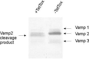 dilution: 1 : 1000, sample: crude synaptosomal fraction of rat brain (P2) (VAMP1, 2, 3 (AA 1-81) Antikörper)