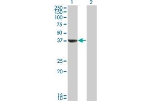 Western Blot analysis of TAF5L expression in transfected 293T cell line by TAF5L monoclonal antibody (M01A), clone 1C5. (TAF5L Antikörper  (AA 1-117))