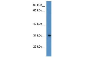 Western Blot showing ROPN1L antibody used at a concentration of 1-2 ug/ml to detect its target protein. (ROPN1L Antikörper  (N-Term))