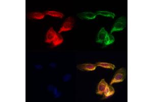 ABIN7094202 and ABIN7098248 staining Hela cells by IF/ICC.