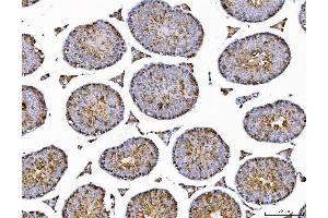 IHC analysis of AHA1/AHSA1 using anti-AHA1/AHSA1 antibody (ABIN7600708).