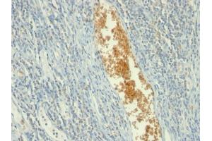 Formalin-fixed, paraffin-embedded human Tonsil stained with AMPD3 Mouse Monoclonal Antibody (AMPD3/901) (AMPD3 Antikörper)