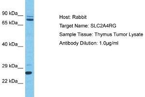 Host: Rabbit Target Name: SLC2A4RG Sample Type: Thymus Tumor lysates Antibody Dilution: 1. (SLC2A4RG Antikörper  (C-Term))