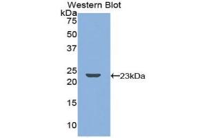 Western Blotting (WB) image for anti-Tumor Necrosis Factor Receptor Superfamily, Member 11a, NFKB Activator (TNFRSF11A) (AA 359-542) antibody (ABIN7439945)