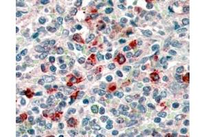 Immunohistochemistry (IHC) image for anti-CD14 (CD14) (Internal Region) antibody (ABIN185563)