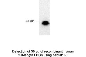 Image no. 1 for anti-F-Box Protein 44 (FBXO44) (C-Term) antibody (ABIN363442) (FBXO44 Antikörper  (C-Term))