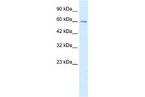 WB Suggested Anti-MYEF2 Antibody Titration:  0. (MYEF2 Antikörper  (Middle Region))