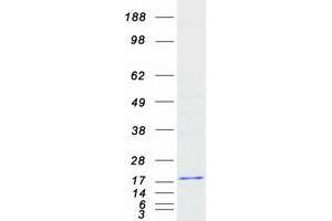 Western Blotting (WB) image for Synaptojanin 2 Binding Protein (SYNJ2BP) protein (Myc-DYKDDDDK Tag) (ABIN2733102)