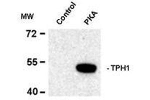 Western blots of recombinant tryptophan hydroxylase incubated in the absence (Control) and presence of cAMP-dependent protein kinase (PKA) showing specific immunolabeling of the ~53k tryptophan hydroxylase protein phosphorylated at Ser58. (Tryptophan Hydroxylase 1 Antikörper  (pSer58))