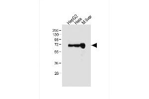All lanes : Anti-ALB Antibody (C-term) at 1:1000 dilution Lane 1: HepG2 whole cell lysate Lane 2: Hela whole cell lysate Lane 3: Mouse liver tissue lysate Lysates/proteins at 20 μg per lane. (Albumin Antikörper  (C-Term))