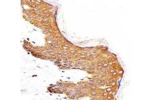 IHC analysis of FFPE human skin section using Epidermal Growth Factor Receptor antibody