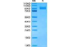 MME Protein (AA 53-750) (His tag)