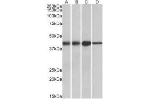 Western blot analysis: ACAT1 antibody staining of Mouse (A) and Rat (B) kidney lysates, and Mouse (C) and Rat (D) Liver lysates at 0. (ACAT1 Antikörper  (Internal Region))