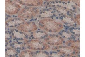 Detection of GAL8 in Human Kidney Tissue using Polyclonal Antibody to Galectin 8 (GAL8) (LGALS8 Antikörper  (AA 1-317))