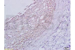 Formalin-fixed paraffin embedded rat ovary tissue labeled with Anti-ADRB1 Polyclonal Antibody, Unconjugated (ABIN669351) at 1:200 followed by conjugation to the secondary antibody and DAB staining (ADRB1 Antikörper  (AA 181-250))