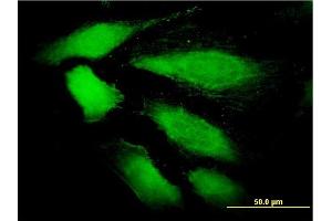 Immunofluorescence of monoclonal antibody to DDEF1 on HeLa cell.