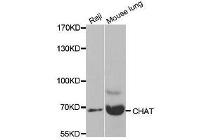 Western blot analysis of extracts of various cell lines, using CHAT antibody. (Choline Acetyltransferase Antikörper  (AA 331-630))