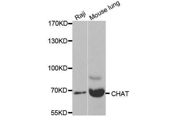 Choline Acetyltransferase Antikörper  (AA 331-630)