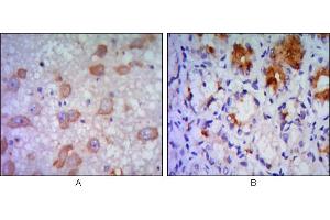 Immunohistochemical analysis of paraffin-embedded human brain tissue (A) and stomach tissue (B), showing cytoplasmic localization using ERN1 mouse mAb with DAB staining. (ERN1 Antikörper)