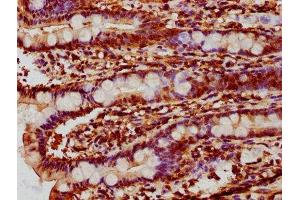 Immunohistochemistry (IHC) image for anti-DNA Fragmentation Factor, 40kDa, beta Polypeptide (Caspase-Activated DNase) (DFFB) (AA 108-219) antibody (ABIN7150177)