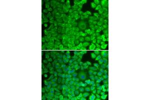 Immunofluorescence (IF) image for anti-Glycogen Synthase 1 (Muscle) (GYS1) antibody (ABIN1872925) (Glycogen Synthase 1 Antikörper)