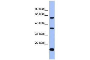 LARP6 antibody used at 1 ug/ml to detect target protein.