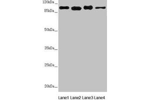 Western blot All lanes: DHTKD1 antibody at 1. (DHTKD1 Antikörper  (AA 1-280))