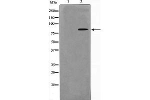 Western blot analysis on HuvEc cell lysate using Phospho-Nibrin(Ser278) Antibody，The lane on the left is treated with the antigen-specific peptide. (Nibrin Antikörper  (pSer278))