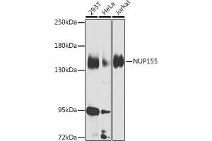 Western blot analysis of extracts of various cell lines, using NUP155 Antibody (ABIN6128363, ABIN6144953, ABIN6144954 and ABIN6223714) at 1:1000 dilution. (NUP155 Antikörper  (AA 1102-1391))